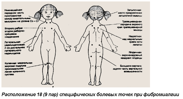 Лимфоузлы на затылке расположение схема у детей